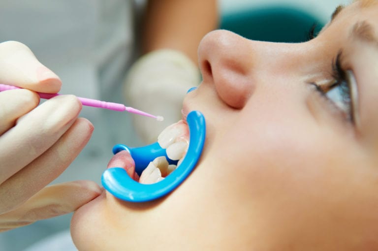 Best General Dentist Office in Cupertino